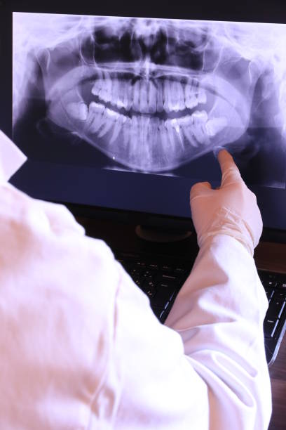 Best Emergency Dental Care for Broken or Chipped Teeth in Byrnes Mill, MO