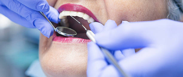 Best Emergency Treatment for Dental Infections or Abscesses in Byrnes Mill, MO